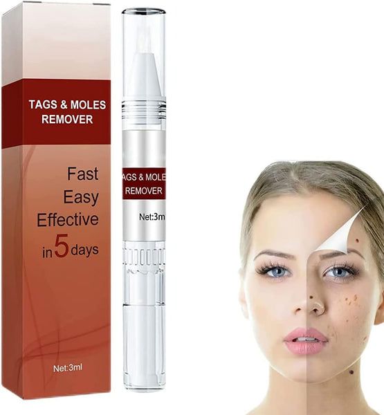 Tags & Moles Remover